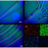Publication on the Isolation and Removal of Round Spermatids from a Spermatogenic Cell Sample Using Microfluidics